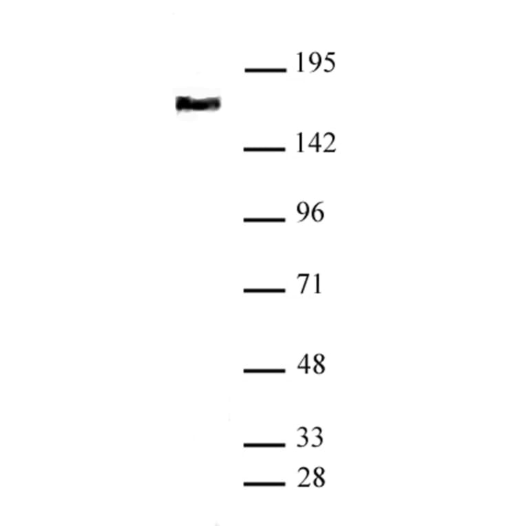 Western Blot - Anti-SMC4 Antibody (A320175) - Antibodies.com
