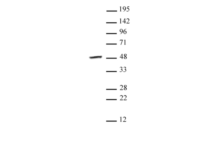 Western Blot - Anti-SMYD3 Antibody (A320176) - Antibodies.com