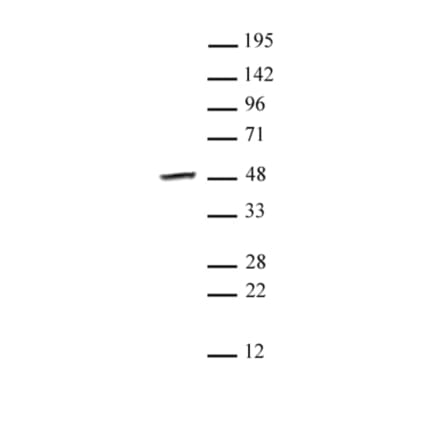 Western Blot - Anti-SMYD3 Antibody (A320176) - Antibodies.com