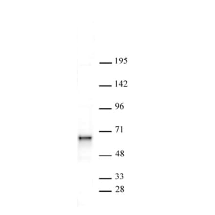 Western Blot - Anti-SOX11 Antibody (A320177) - Antibodies.com