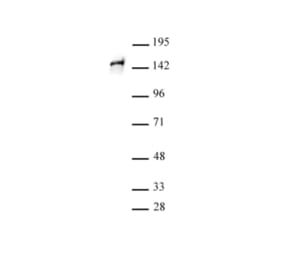 Western Blot - Anti-SA1 Antibody (A320178) - Antibodies.com