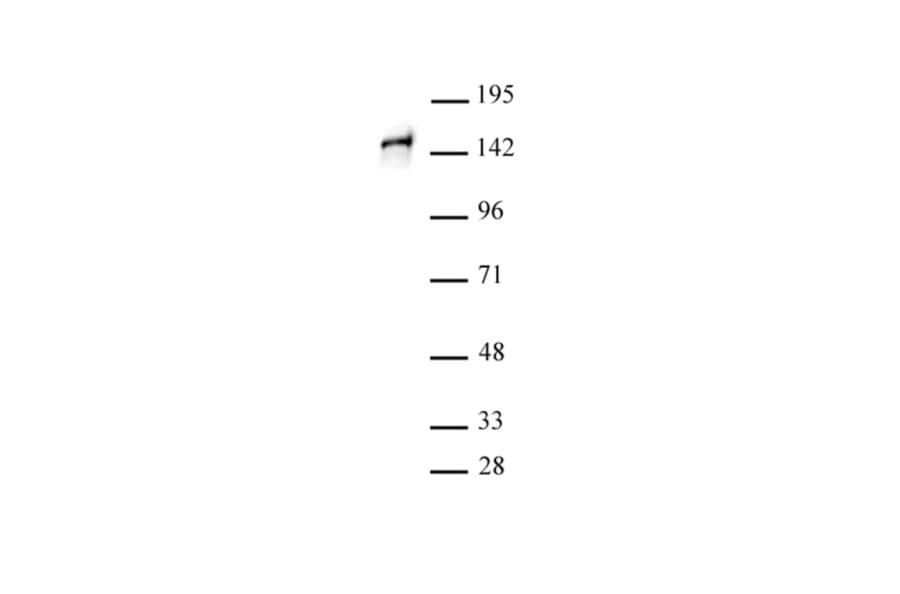 Western Blot - Anti-SA1 Antibody (A320178) - Antibodies.com