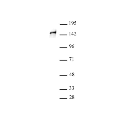 Western Blot - Anti-SA1 Antibody (A320178) - Antibodies.com