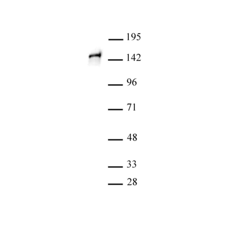 Western Blot - Anti-SA1 Antibody (A320178) - Antibodies.com
