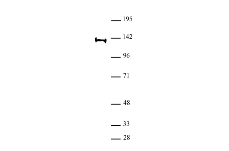 Western Blot - Anti-SUPT16H Antibody (A320179) - Antibodies.com