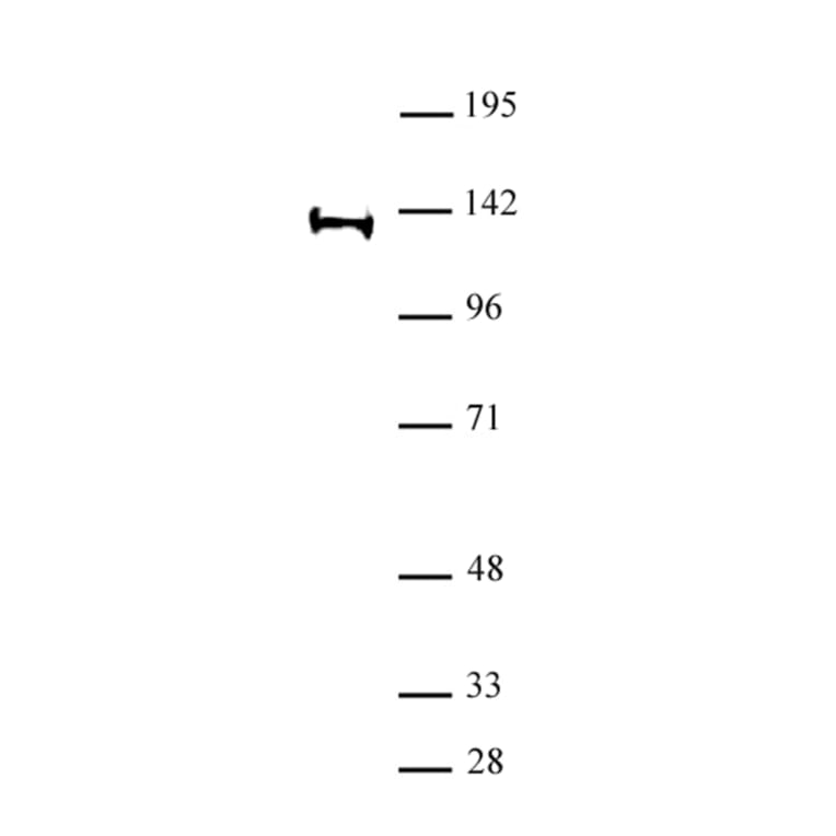 Western Blot - Anti-SUPT16H Antibody (A320179) - Antibodies.com