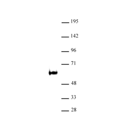 Western Blot - Anti-TDG Antibody (A320181) - Antibodies.com