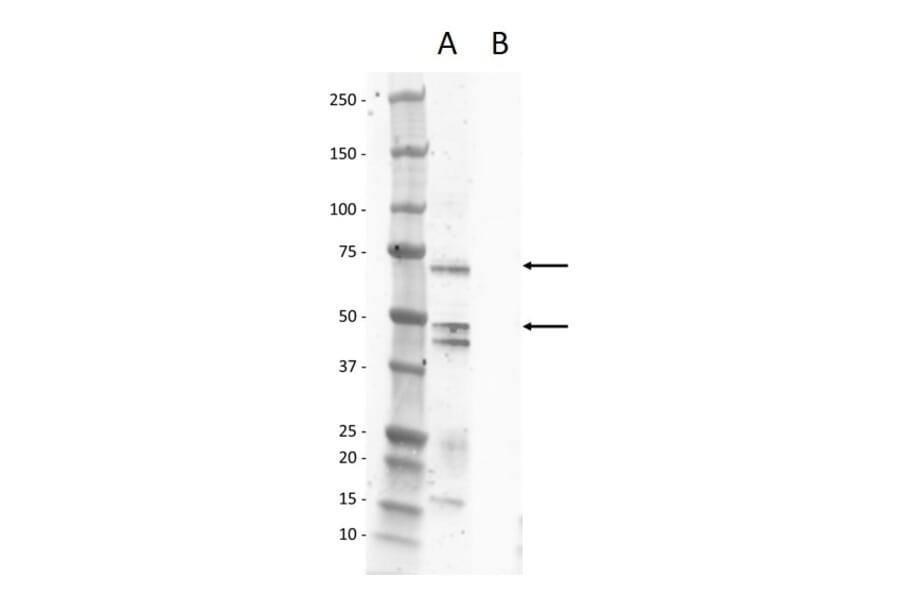 Western Blot - Anti-Calcitonin Receptor / CT-R Antibody (A320187) - Antibodies.com