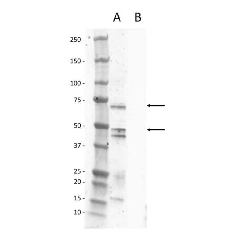 Western Blot - Anti-Calcitonin Receptor / CT-R Antibody (A320187) - Antibodies.com