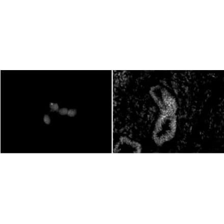 Immunofluorescence  - Anti-CHD5 Antibody [5A10] (A320276) - Antibodies.com