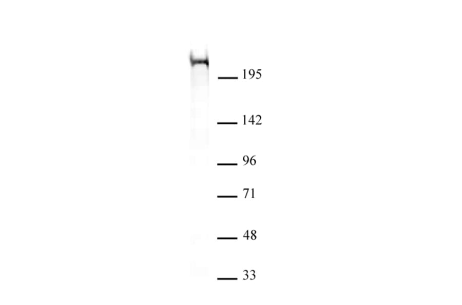 Western Blot - Anti-CHD5 Antibody [5A10] (A320276) - Antibodies.com