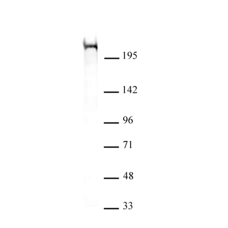 Western Blot - Anti-CHD5 Antibody [5A10] (A320276) - Antibodies.com