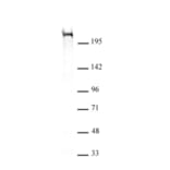 Western Blot - Anti-CHD5 Antibody [5A10] (A320276) - Antibodies.com
