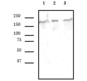 Western Blot - Anti-BRG1 Antibody [5B7] (A320277) - Antibodies.com