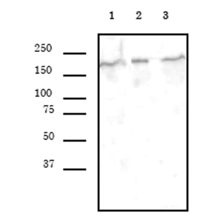 Western Blot - Anti-BRG1 Antibody [5B7] (A320277) - Antibodies.com
