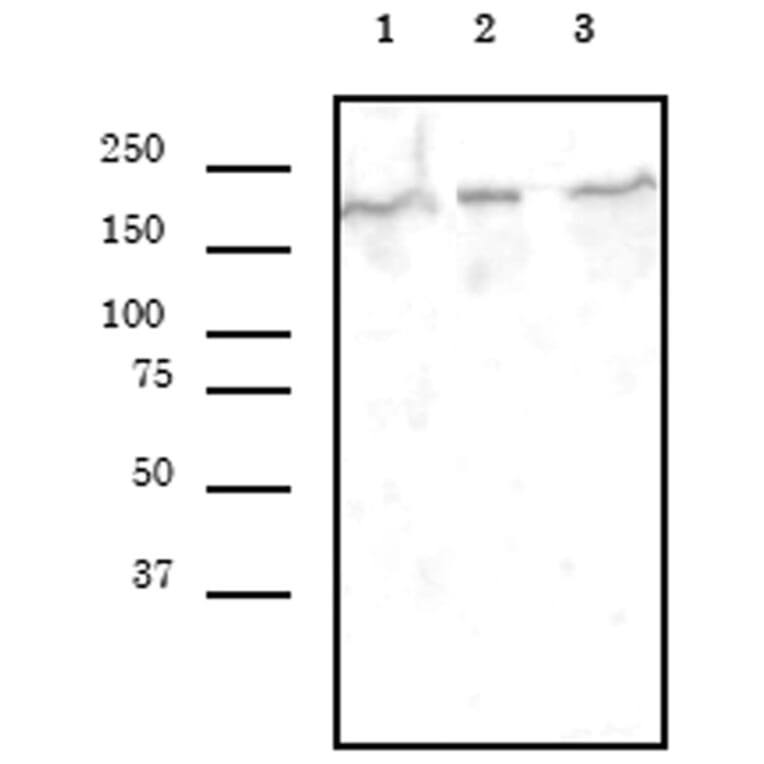 Western Blot - Anti-BRG1 Antibody [5B7] (A320277) - Antibodies.com