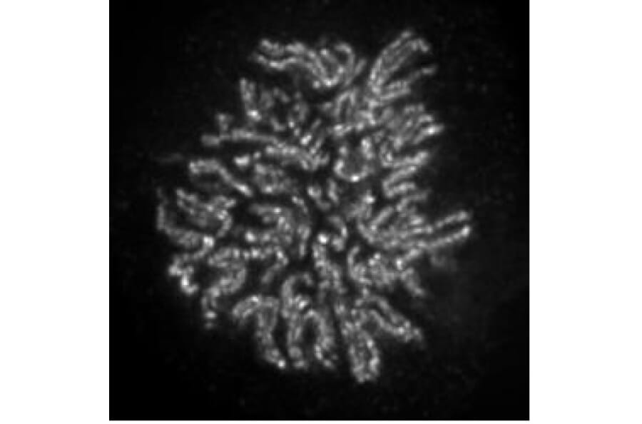 Immunofluorescence  - Anti-NCAPH2 Antibody [5F2G4] (A320279) - Antibodies.com