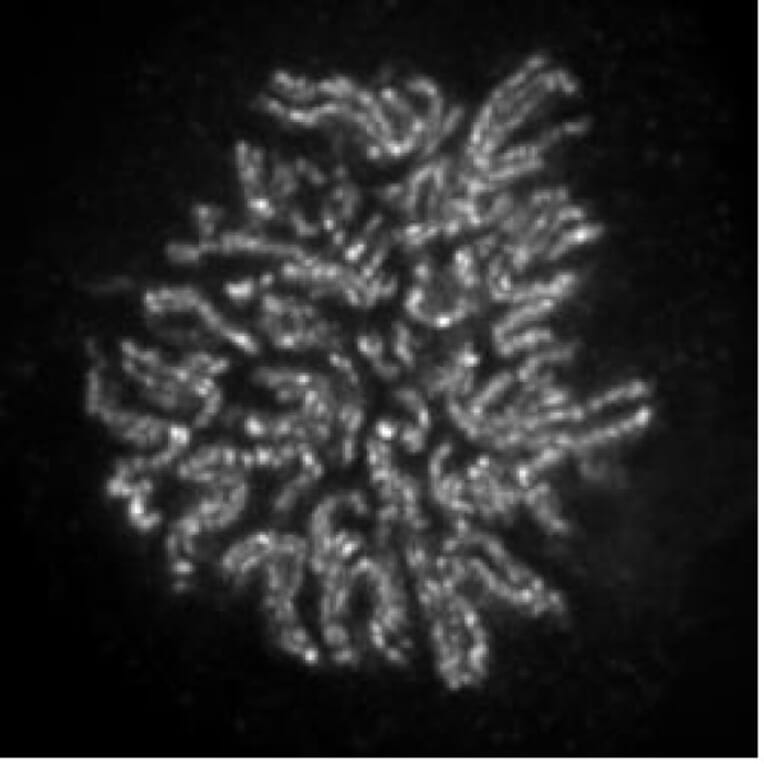 Immunofluorescence  - Anti-NCAPH2 Antibody [5F2G4] (A320279) - Antibodies.com