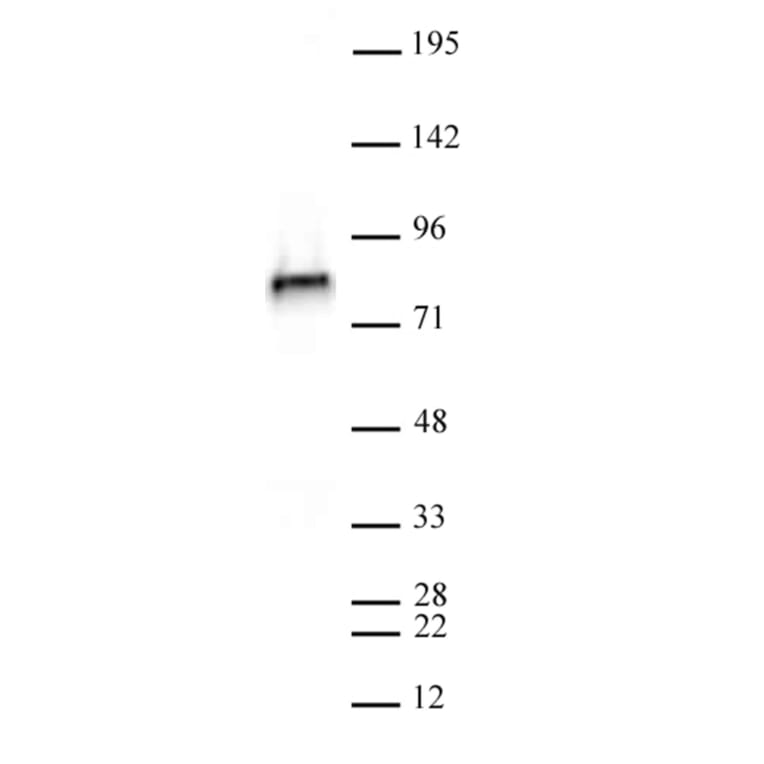 Western Blot - Anti-NCAPH2 Antibody [5F2G4] (A320279) - Antibodies.com