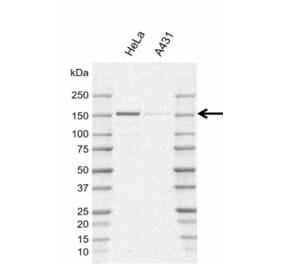 Western Blot - Anti-POLR3A Antibody [AB01/1E10] (A320292) - Antibodies.com
