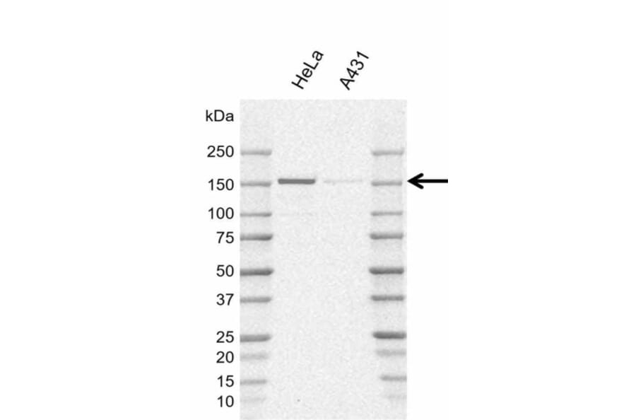 Western Blot - Anti-POLR3A Antibody [AB01/1E10] (A320292) - Antibodies.com