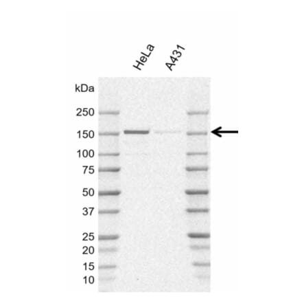 Western Blot - Anti-POLR3A Antibody [AB01/1E10] (A320292) - Antibodies.com