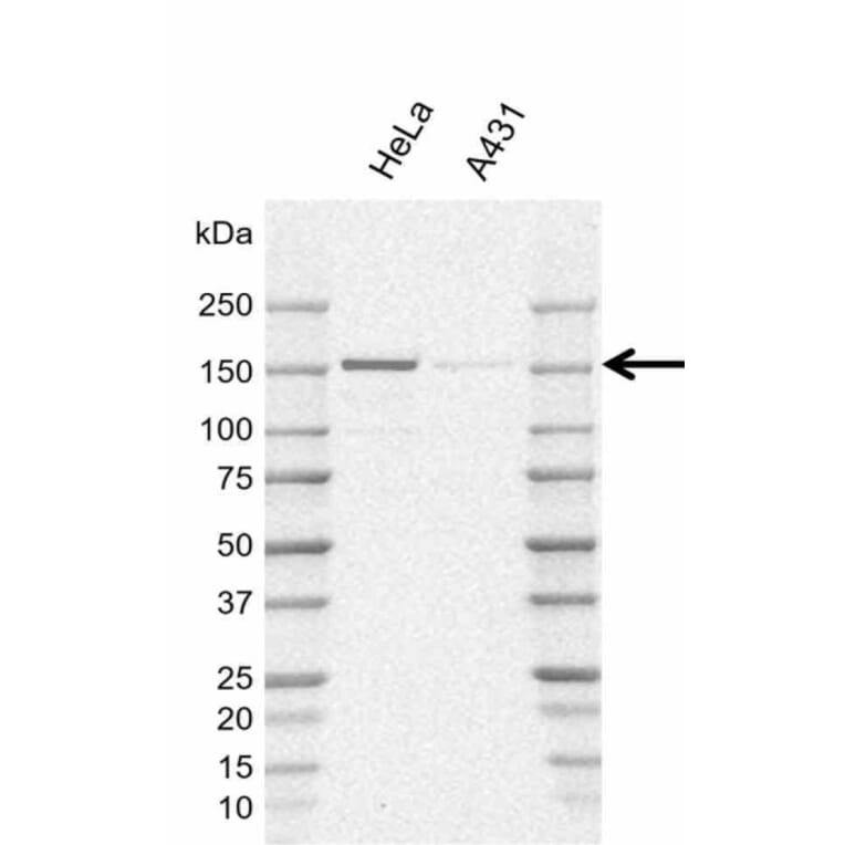 Western Blot - Anti-POLR3A Antibody [AB01/1E10] (A320292) - Antibodies.com