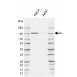 Western Blot - Anti-POLR3A Antibody [AB01/1E10] (A320292) - Antibodies.com