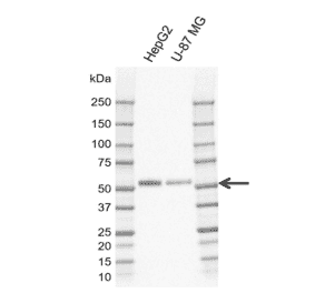 Western Blot - Anti-MIG-6 Antibody [CD02-3E1] (A320294) - Antibodies.com