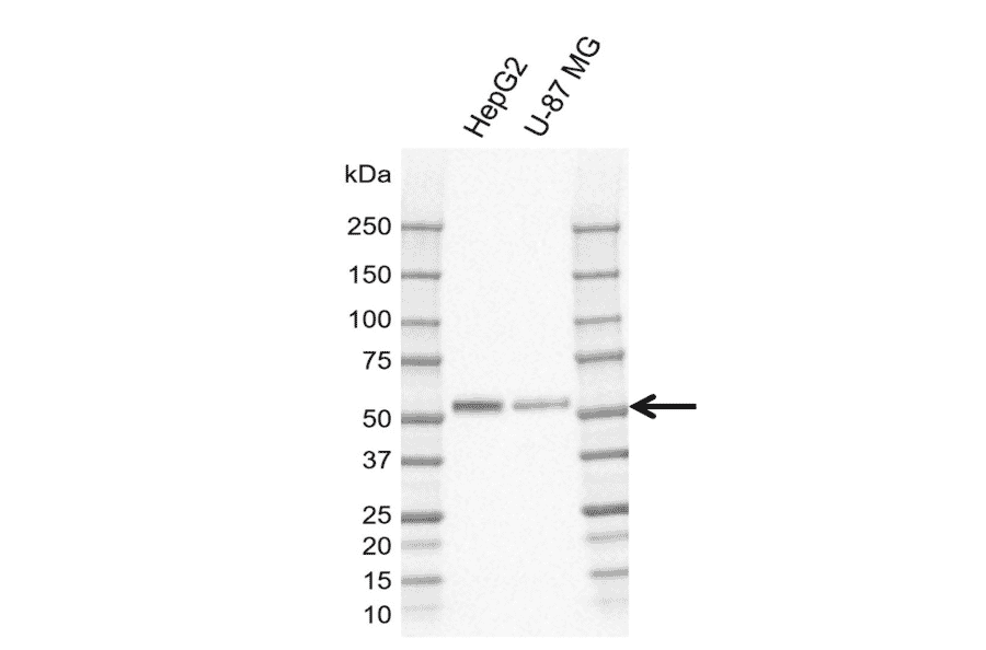 Western Blot - Anti-MIG-6 Antibody [CD02-3E1] (A320294) - Antibodies.com