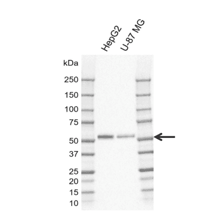 Western Blot - Anti-MIG-6 Antibody [CD02-3E1] (A320294) - Antibodies.com
