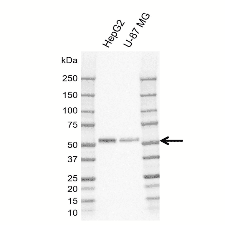 Western Blot - Anti-MIG-6 Antibody [CD02-3E1] (A320294) - Antibodies.com