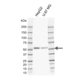Western Blot - Anti-MIG-6 Antibody [CD02-3E1] (A320294) - Antibodies.com