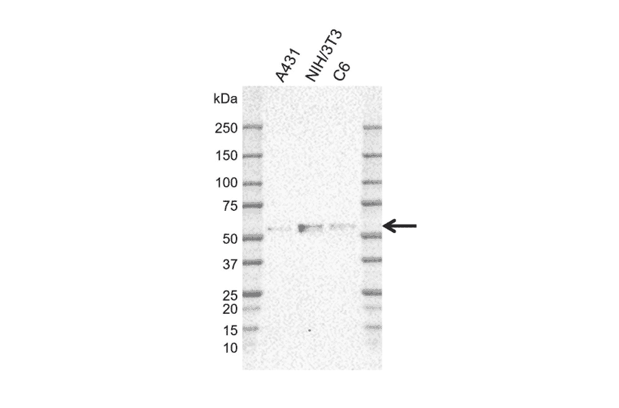 Western Blot - Anti-MIG-6 Antibody [CD02-3E1] (A320294) - Antibodies.com