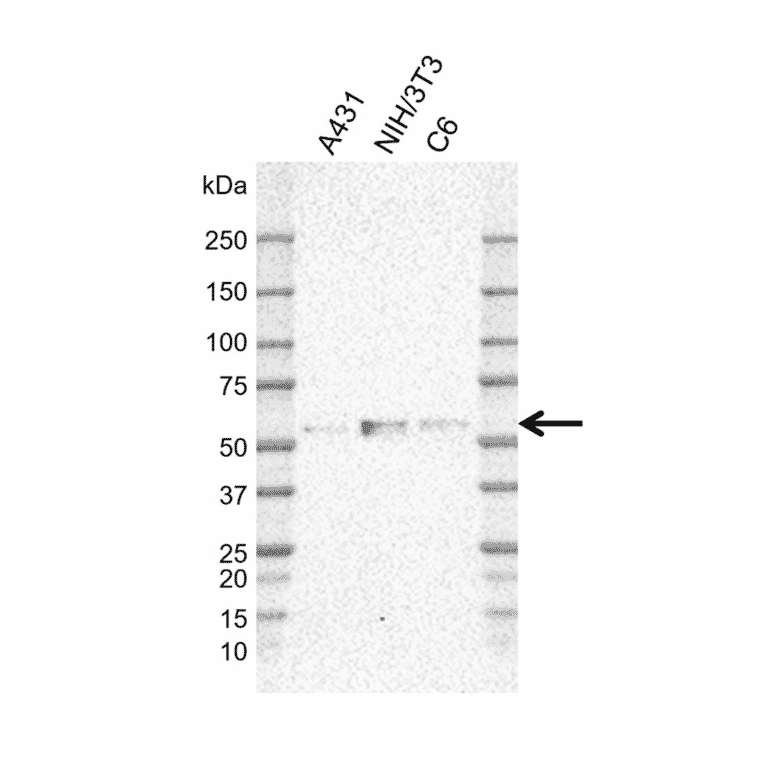 Western Blot - Anti-MIG-6 Antibody [CD02-3E1] (A320294) - Antibodies.com
