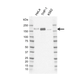 Western Blot - Anti-IRS2 Antibody [G01-8F7] (A320295) - Antibodies.com