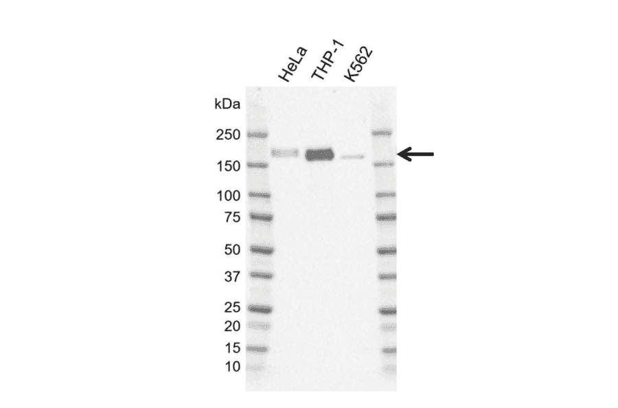Western Blot - Anti-IRS2 Antibody [G01-8F7] (A320295) - Antibodies.com