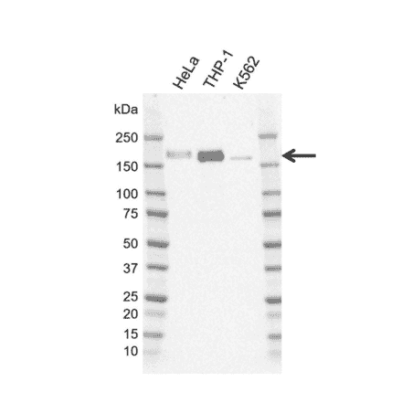 Western Blot - Anti-IRS2 Antibody [G01-8F7] (A320295) - Antibodies.com