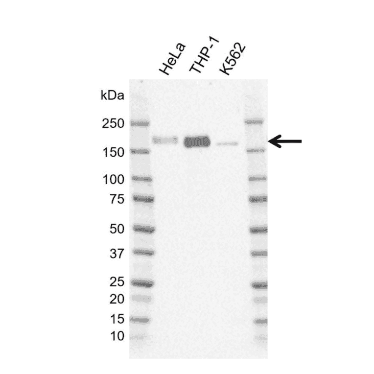 Western Blot - Anti-IRS2 Antibody [G01-8F7] (A320295) - Antibodies.com