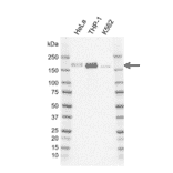 Western Blot - Anti-IRS2 Antibody [G01-8F7] (A320295) - Antibodies.com