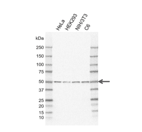 Western Blot - Anti-PPP2R5E Antibody [IJ01-4C1] (A320297) - Antibodies.com