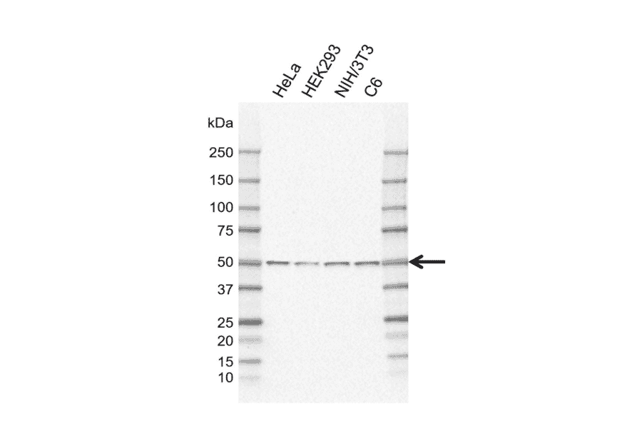 Western Blot - Anti-PPP2R5E Antibody [IJ01-4C1] (A320297) - Antibodies.com