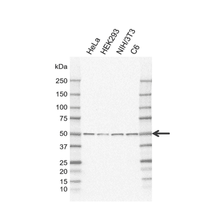 Western Blot - Anti-PPP2R5E Antibody [IJ01-4C1] (A320297) - Antibodies.com