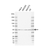 Western Blot - Anti-PPP2R5E Antibody [IJ01-4C1] (A320297) - Antibodies.com