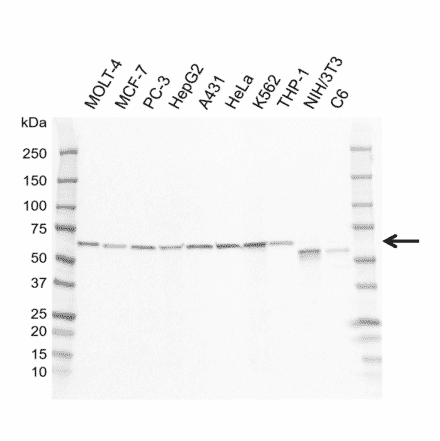 Western Blot - Anti-GRB14 Antibody [I01-10B4] (A320298) - Antibodies.com