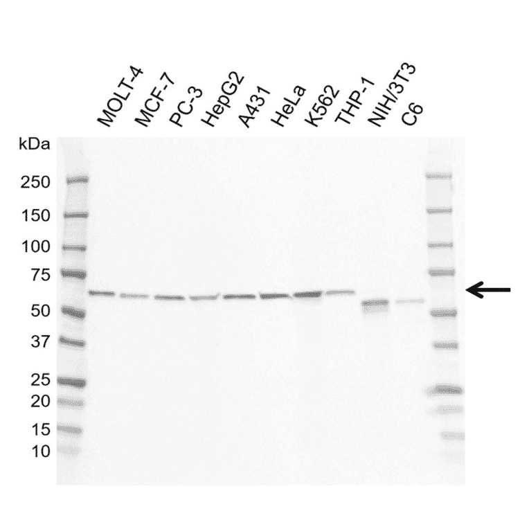 Western Blot - Anti-GRB14 Antibody [I01-10B4] (A320298) - Antibodies.com