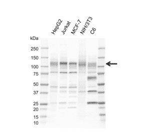 Western Blot - Anti-NFkB Inducing Kinase NIK Antibody [EF02-1H3] (A320299) - Antibodies.com
