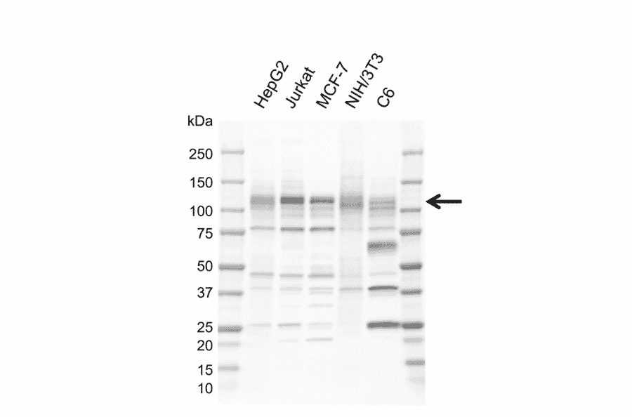 Western Blot - Anti-NFkB Inducing Kinase NIK Antibody [EF02-1H3] (A320299) - Antibodies.com