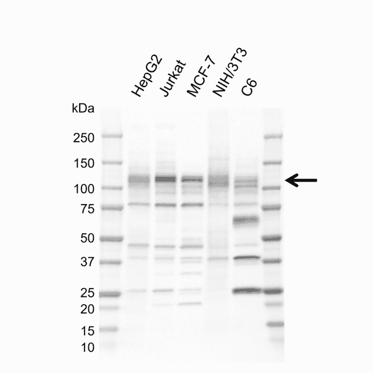 Western Blot - Anti-NFkB Inducing Kinase NIK Antibody [EF02-1H3] (A320299) - Antibodies.com
