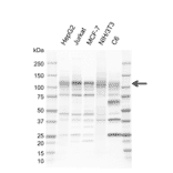 Western Blot - Anti-NFkB Inducing Kinase NIK Antibody [EF02-1H3] (A320299) - Antibodies.com